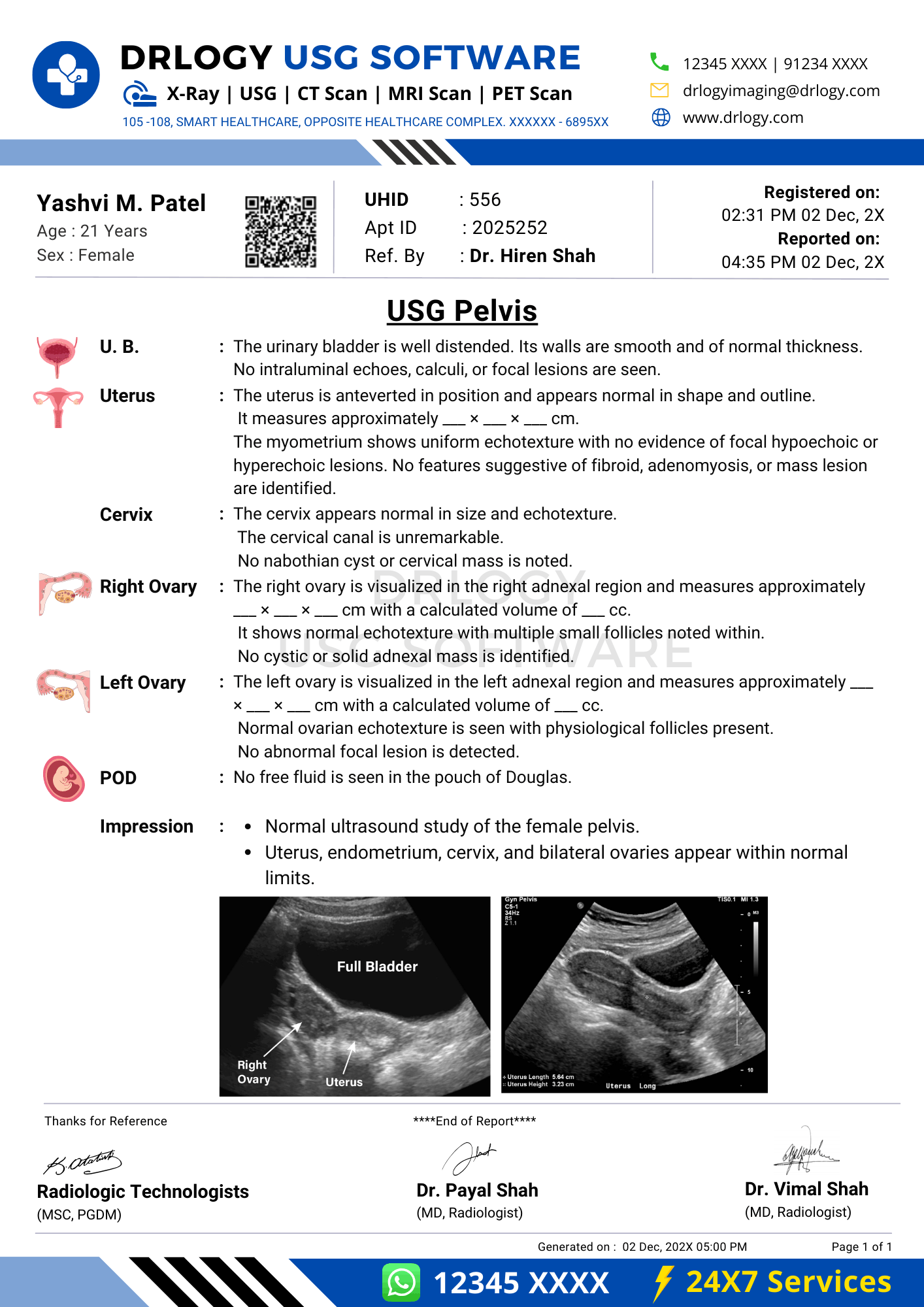 Pelvis ultrasound report format sample in Drlogy USG Reporting Software