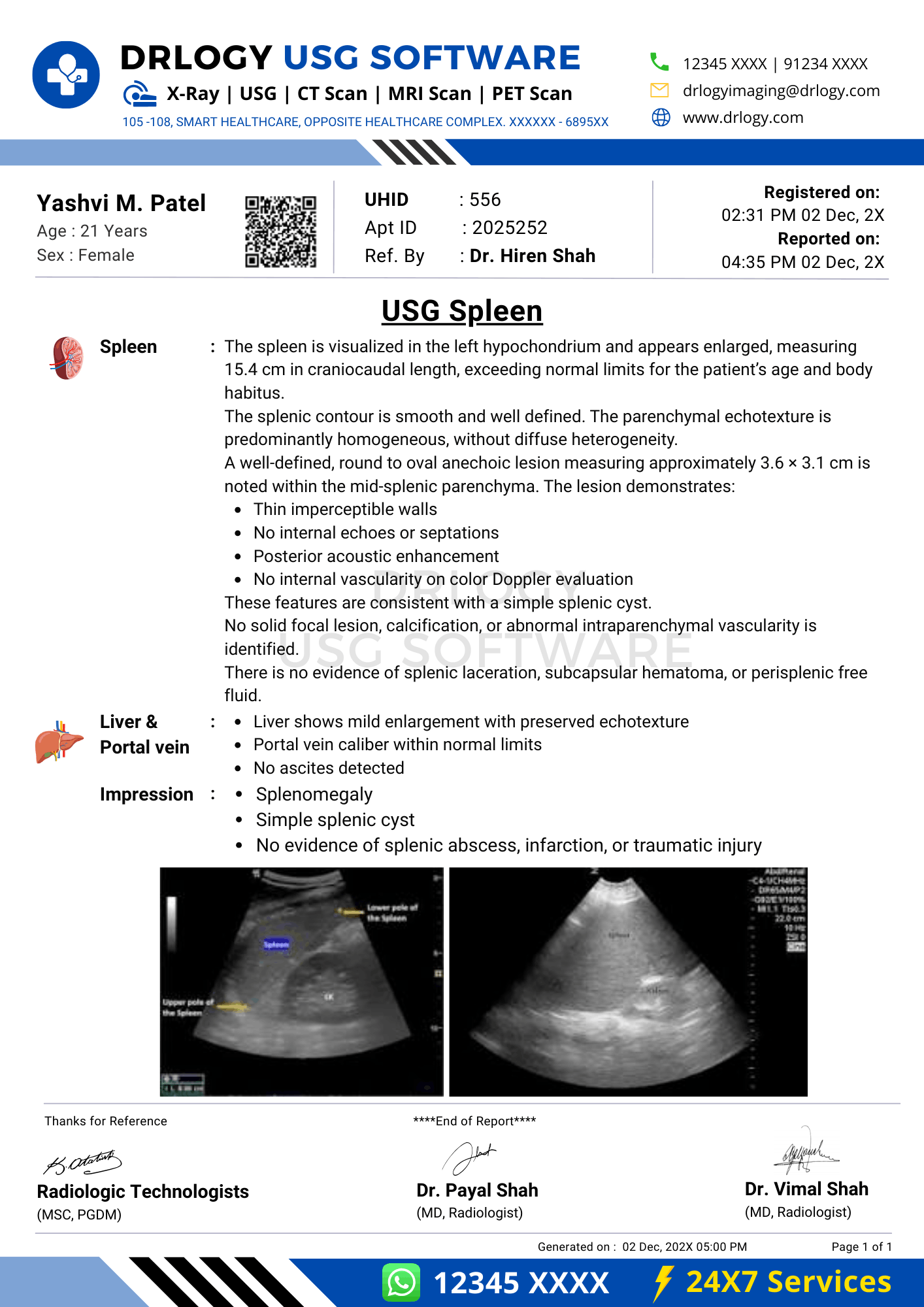 Spleen USG report format template in Drlogy USG Reporting Software