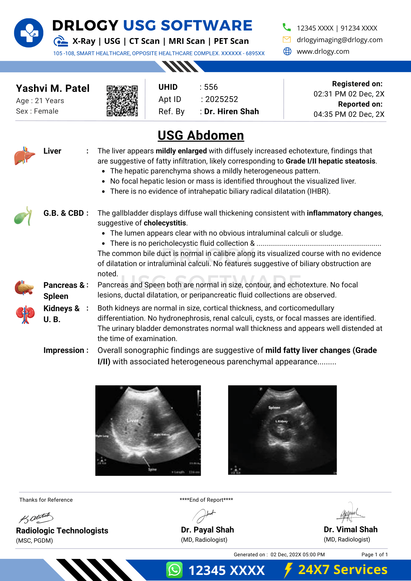 USG Abdomen Report Format