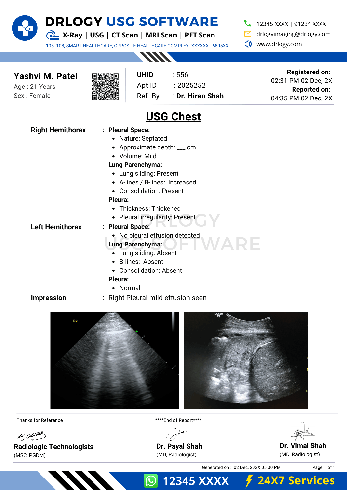 USG chest report format template generated in Drlogy USG Reporting Software