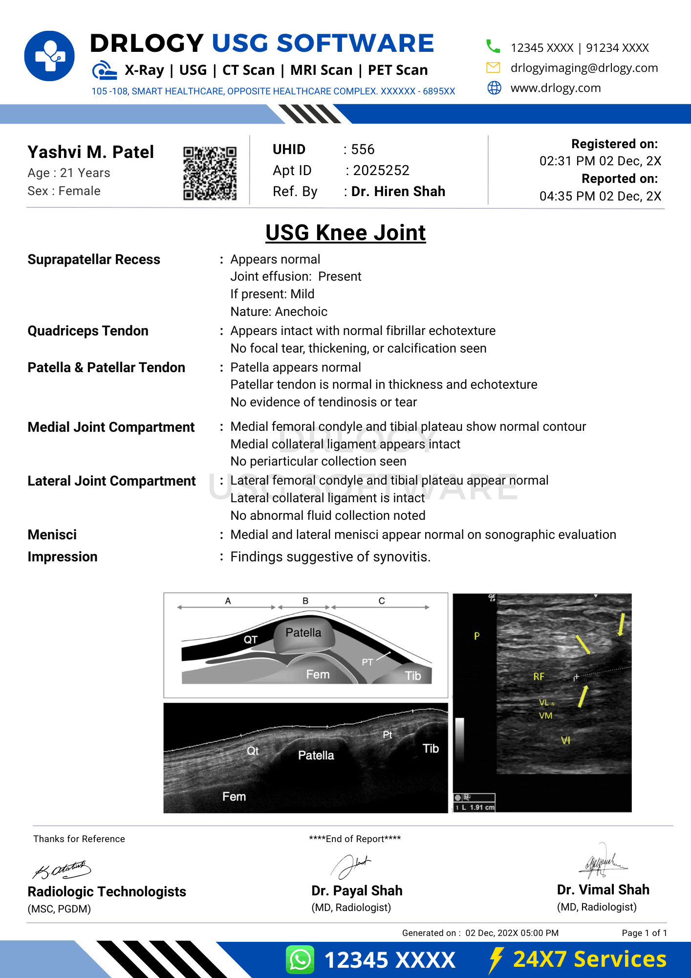 USG knee joint report format example in Drlogy USG Reporting Software