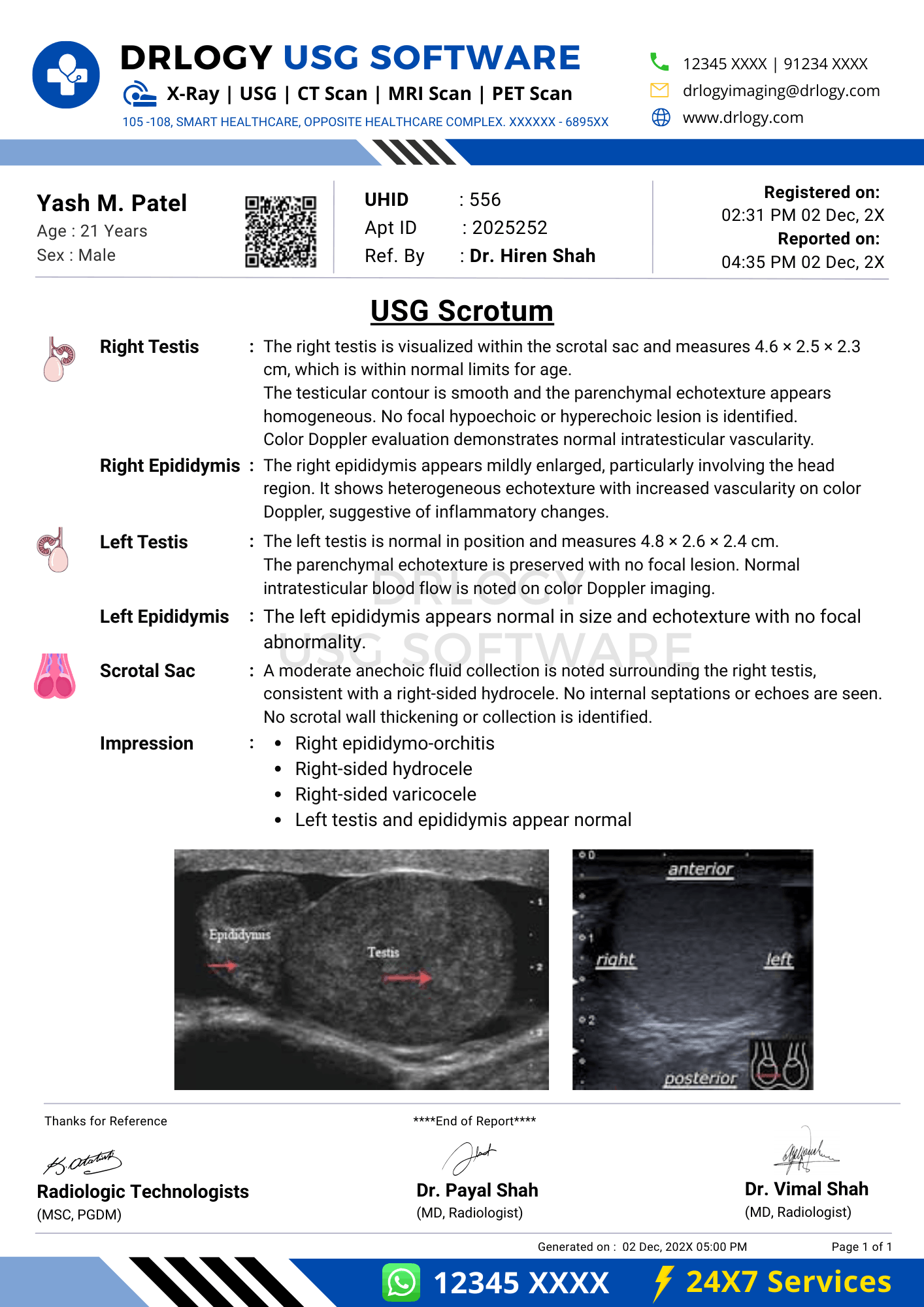 USG scrotum report format example generated in Drlogy USG Reporting Software