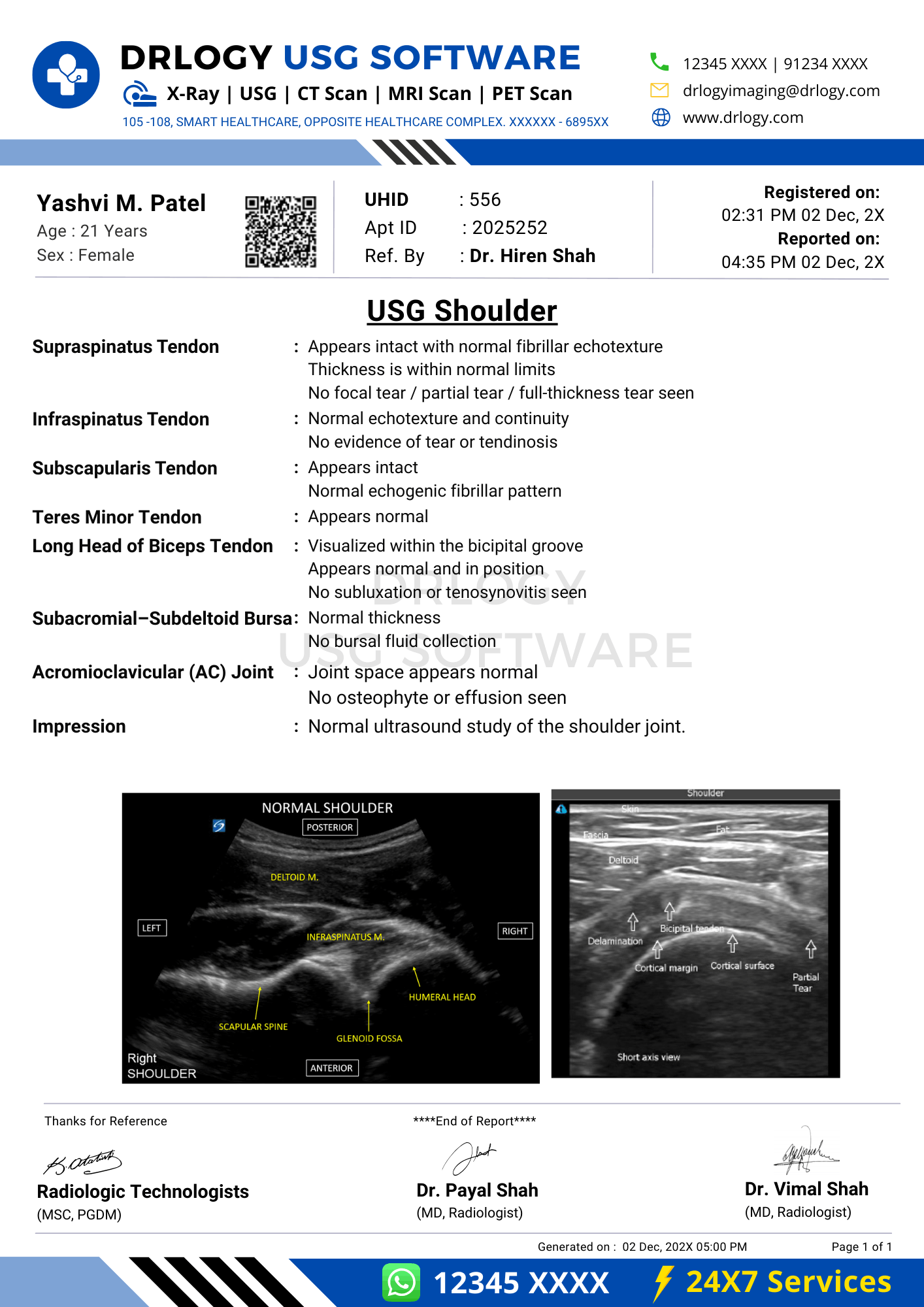 USG shoulder report format sample using Drlogy USG Reporting Software