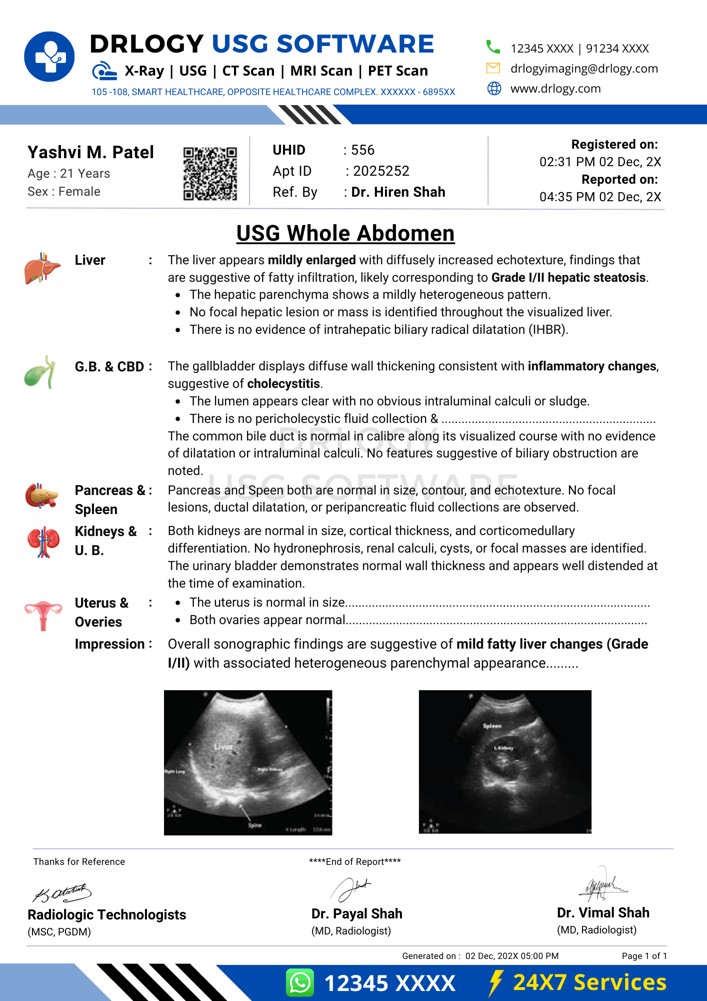 USG whole abdomen report format template generated in Drlogy Plus